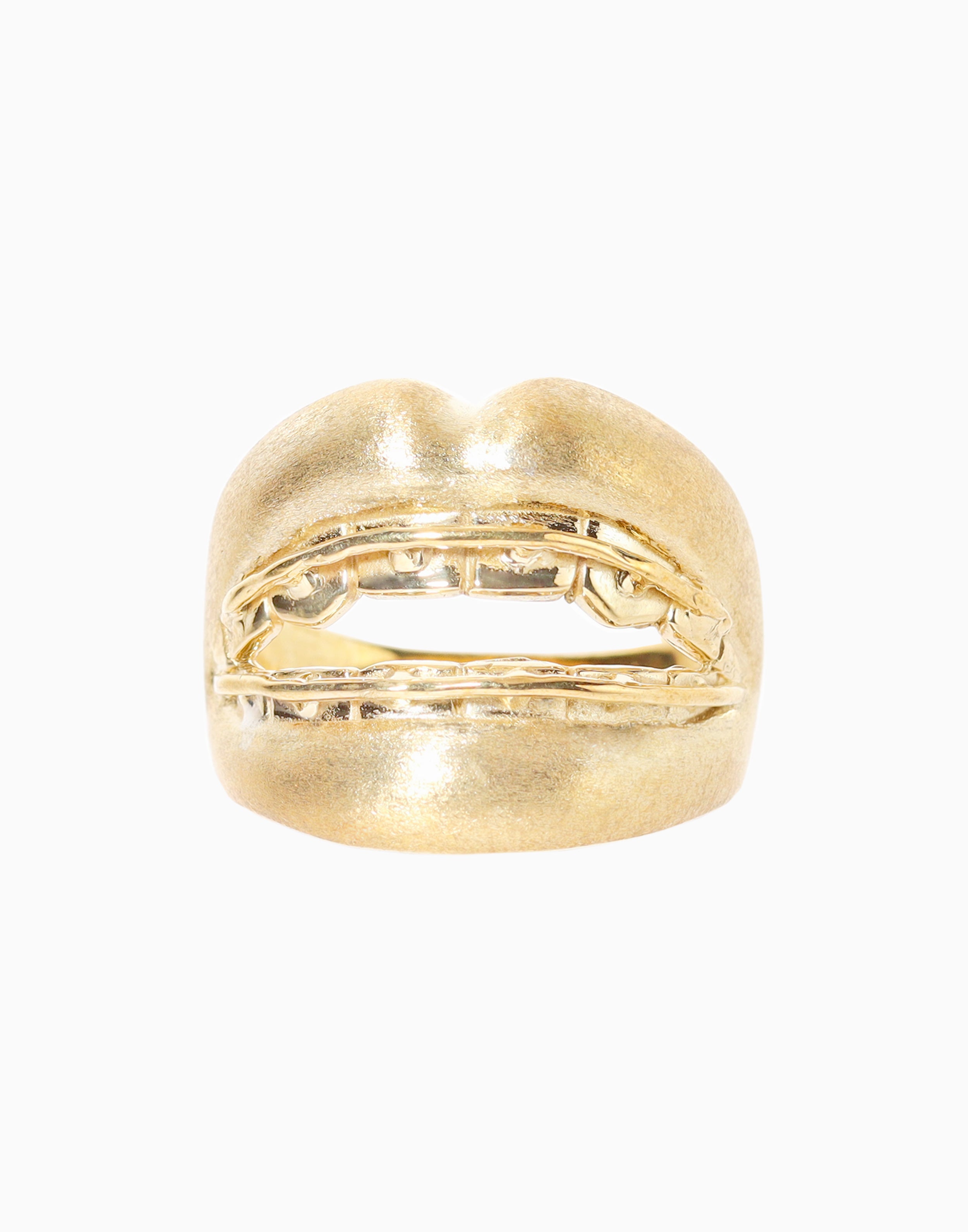 Braceface Ring